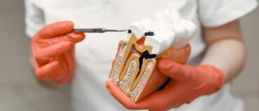 What Are The Signs of Tooth Decay?