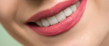 Does Teeth Whitening Actually Work?